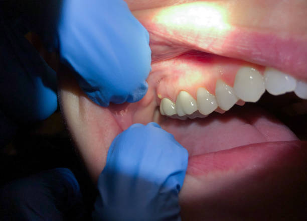 Best Pediatric Emergency Dentist in Audubon, NJ